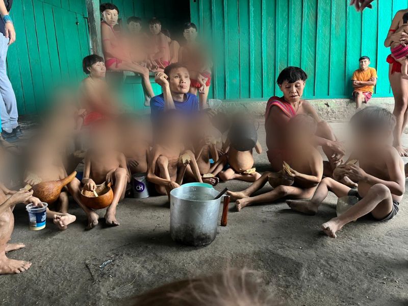 Yanomami children show signs of severe malnutrition (URIHI courtsey)